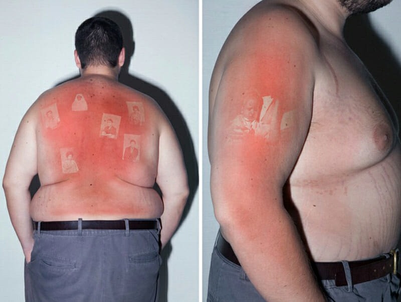 UV sunburn photos from the Illustrated People series by Thomas Mailaender