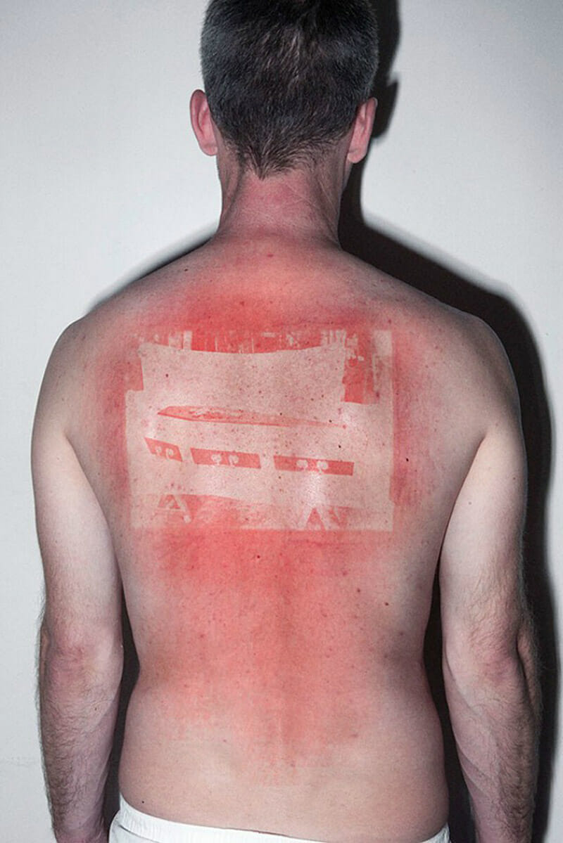 UV sunburn photos from the Illustrated People series by Thomas Mailaender